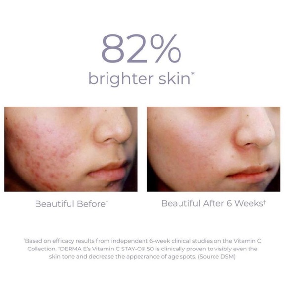 DERMA•E Vitamin C Concentrated Antioxidant Serum - Picture 2 of 5